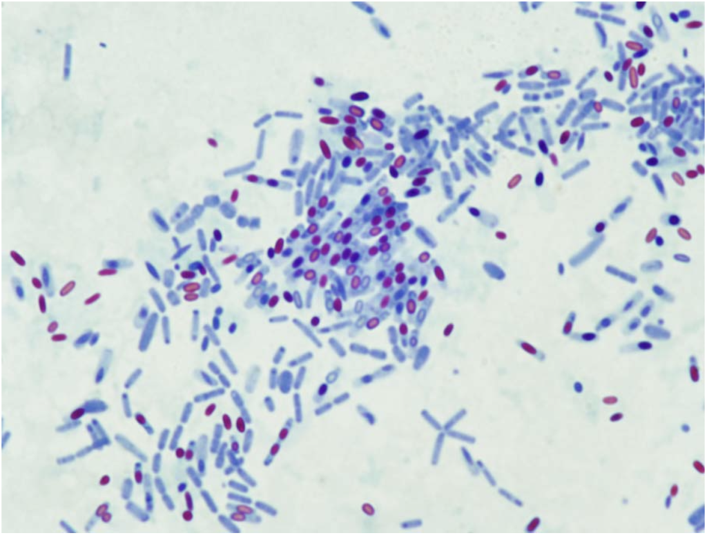pengecaran endospora